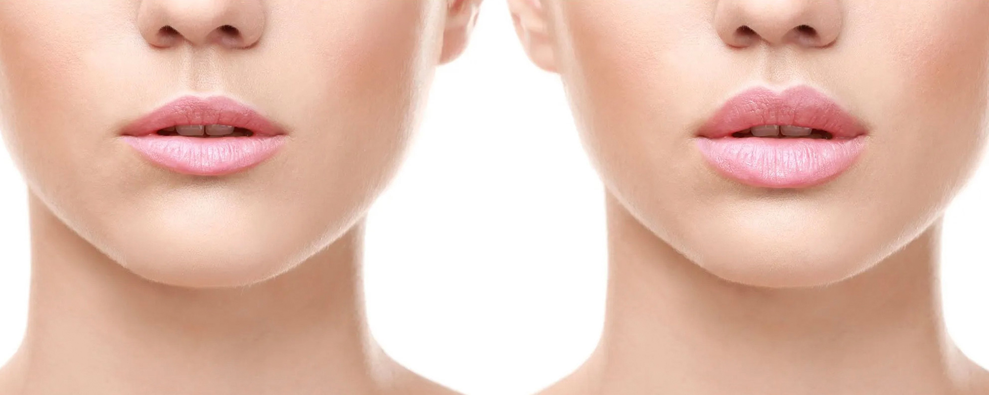 Signature Skin Aesthetics | Lip Enhancements
